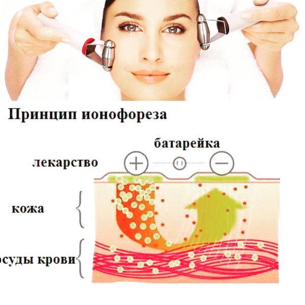 Iontoforesis: qué es en cosmetología, con hiperhidrosis. Precio del procedimiento. Dispositivos para la cara en casa, drogas.
