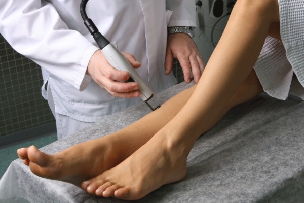 إزالة أوردة الساق المصابة بالدوالي بالليزر. كيف تسير العملية ، فترة ما بعد الجراحة ، إعادة التأهيل ، العواقب ، المضاعفات
