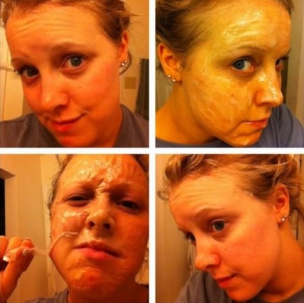 Masker voor het gezicht. Beoordeling van de beste recepten voor rimpels, acne, mee-eters, droge en vette huid. Recepten