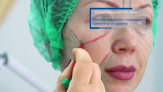 Mesovarton pour la bio-revitalisation du visage. Composition du médicament, fabricant, conséquences, avis des cosmétologues et prix
