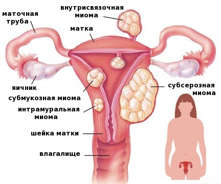 Pourquoi le ventre se développe-t-il chez les femmes après 40, 50 ans et comment l'enlever. Causes et remèdes