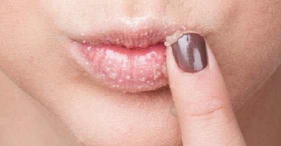 As razões pelas quais os lábios ficam secos nas mulheres, nos homens. Como tratar resfriados, infecções virais respiratórias agudas, menopausa, diabetes, oncologia, durante a gravidez