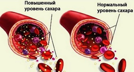 The reasons why lips dry in women, men. How to treat colds, acute respiratory viral infections, menopause, diabetes, oncology, during pregnancy