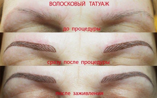 Tatouage des sourcils: méthode capillaire. Avantages et inconvénients, contre-indications, caractéristiques de mise en œuvre, photos avant et après