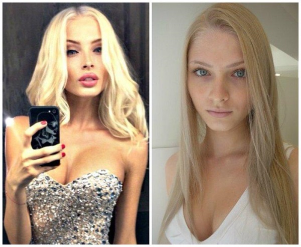 Alena Shishkova. Fotos antes e depois da cirurgia plástica. Biografia, operações de modelo, parâmetros de figura