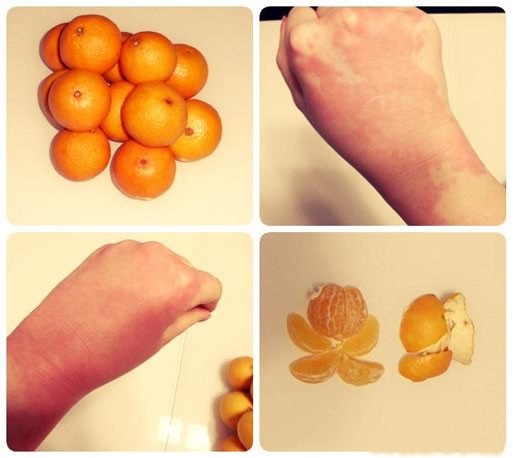 Oranje olie. Toepassing voor haar, nagels, gezichtshuid, cellulitis, striae op het lichaam. Hoe je thuis boter maakt