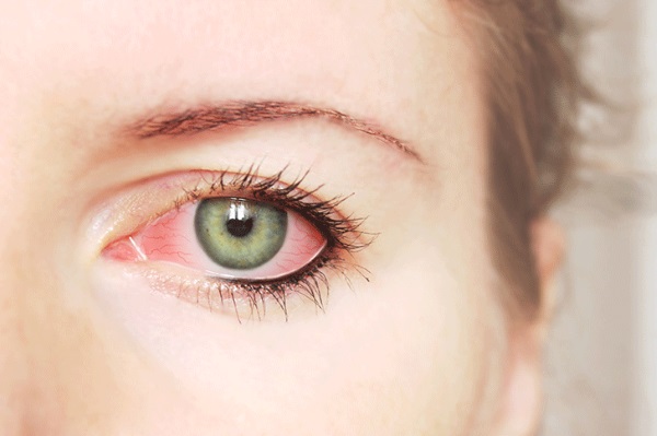 Blefarogel 2. Gebrauchsanweisung, Anwendung von Gerste, Gesicht, Augenlidern, Wimpernwachstum, Schwellung unter den Augen. Analoge