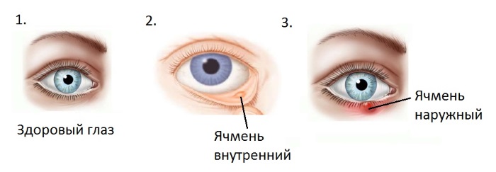 Blefarogel 2. Arahan penggunaan, cara memohon barli, untuk wajah, kelopak mata, pertumbuhan bulu mata, untuk pembengkakan di bawah mata. Analog