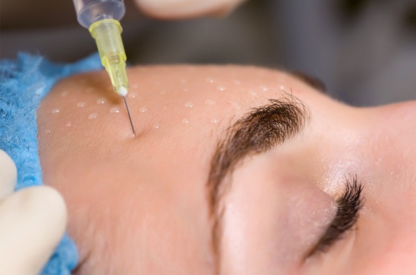 Terapia botulinowa w kosmetologii - co to jest, skuteczność i wyniki, recenzje. Dysport, Xeomin, Botox