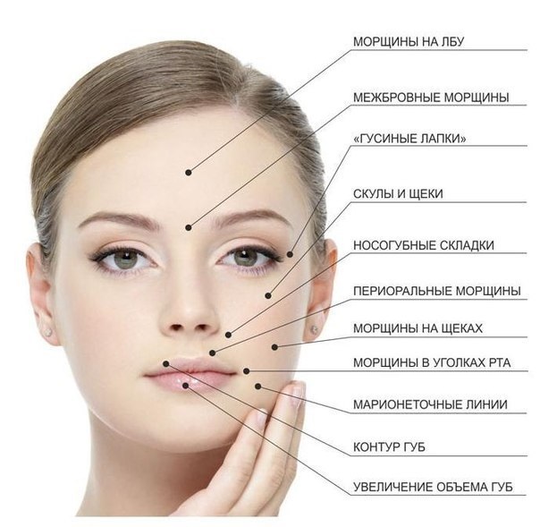Terapia botulínica em cosmetologia - o que é, eficácia e resultados, revisões. Dysport, Xeomin, Botox