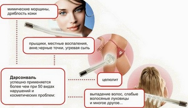 Darsonvalizace - co to je v kosmetologii, výhody postupu pro pokožku obličeje, hlavy, očních víček, vlasů, zařízení. Indikace a kontraindikace, účinnost