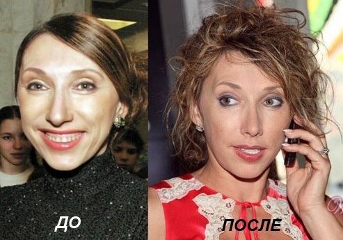 Elena Sparrow. Foto sebelum dan selepas pembedahan plastik, biografi, tinggi badan, berat badan, usia, pembedahan untuk membetulkan penampilan artis