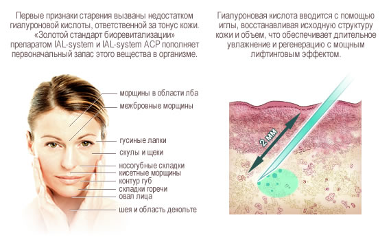 Gialripayer mesolift 02 ، 04 ، 06 ، 07 ، 08. تكوين Bioreparant ، السعر ، استعراض المرضى ، أخصائيي التجميل