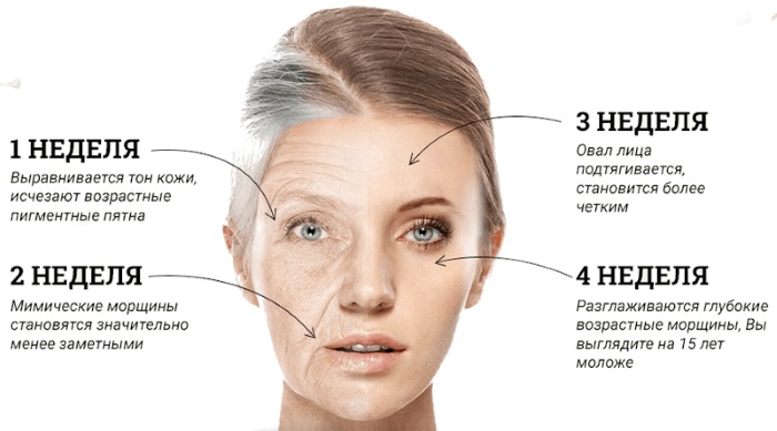 Kollagenarium for ansikt, kropp. Hva er denne prosedyren, legevurderinger, fordelene og skadene ved et solarium for kroppen. Før og etter bilder, bivirkninger