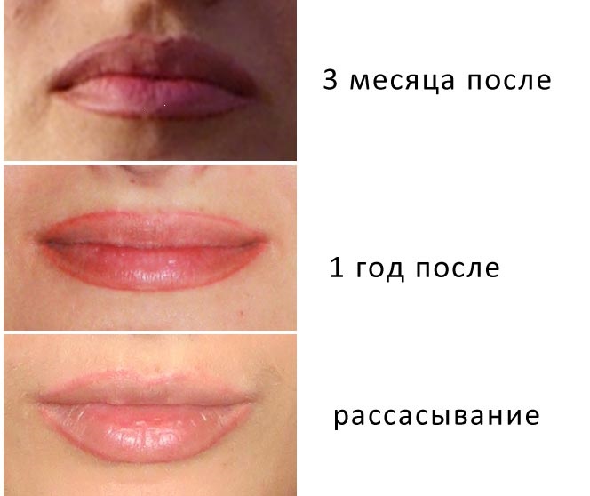 Maquillage permanent des lèvres: avec ombrage, effet d'agrandissement, 3d, ombre, en technique aquarelle, lèvres en velours. Photos avant et après