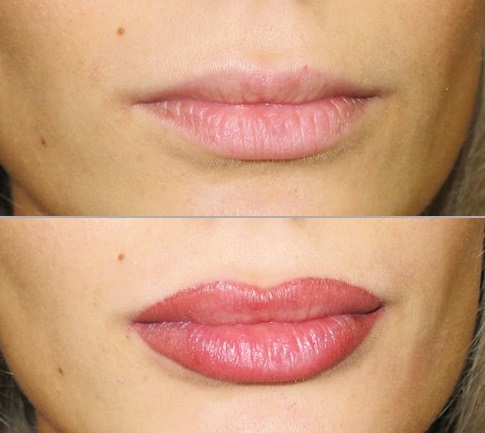 Kalıcı dudak makyajı: gölgeleme, büyütme efekti, 3d, ombre, sulu boya tekniğinde, kadife dudaklı. Fotoğraflardan önce ve sonra
