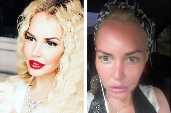 Masha Malinovskaya avant et après la chirurgie plastique. Photo, âge, taille et poids