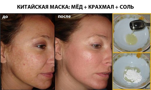 Starch face mask with botox effect, anti-wrinkle, for dry skin, with kefir, banana, soda, salt, olive oil. Recipes