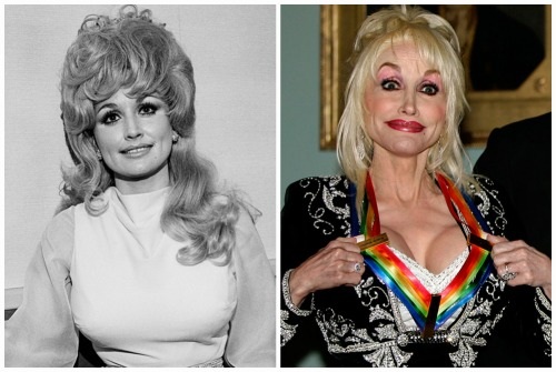 As 10 melhores estrelas da cirurgia plástica sem sucesso. Fotos antes e depois de atores soviéticos, russos, estrangeiros e de Hollywood