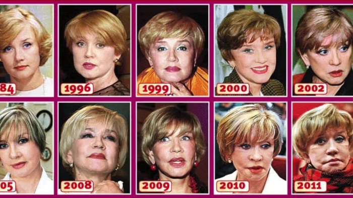 Le 10 migliori star della chirurgia plastica senza successo. Foto prima e dopo attori sovietici, russi, stranieri, hollywoodiani