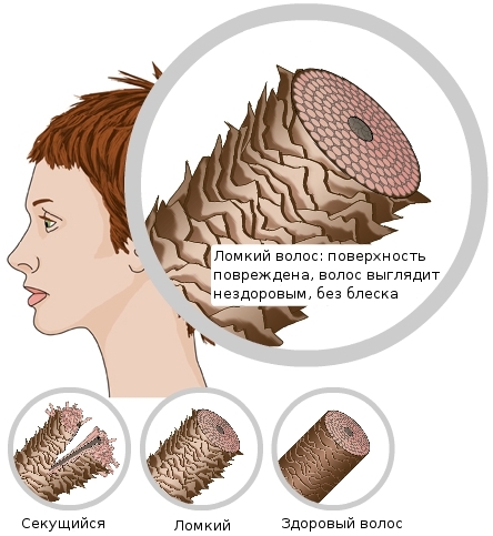 Protezione termica per capelli dalla stiratura: spray, lozione, olio, crema. Valutazione dei migliori strumenti e recensioni