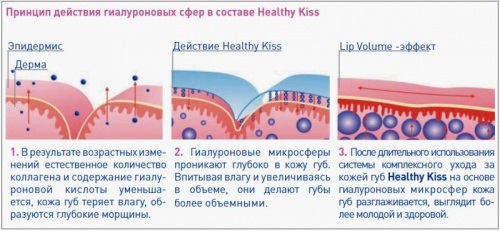 Lippenvergrößerung zu Hause: Rezepte für Masken, Peelings, Hyaluronsäure, Nikotinsäure. Übung, Massage, Vakuum