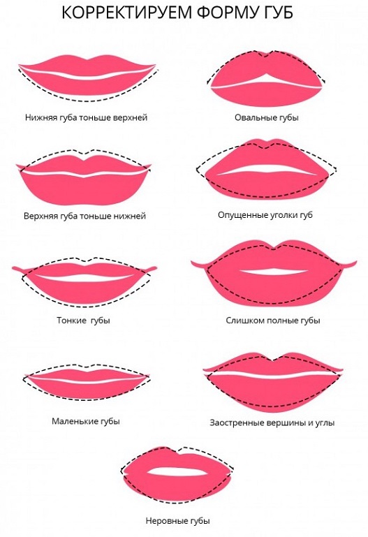 Pembesaran bibir dengan asid hyaluronik, pengisi, botox, silikon, plastik kontur. Foto, harga, ulasan