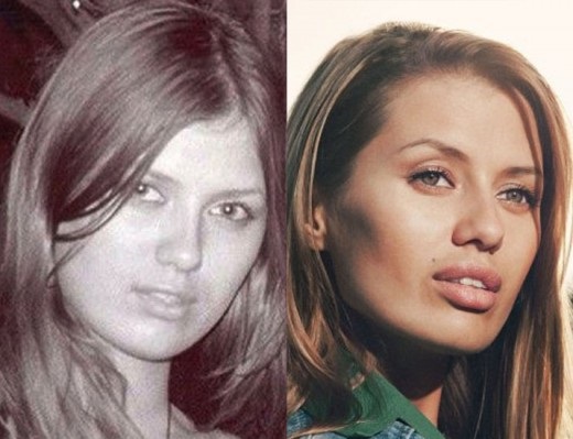 Victoria Bonya trước và sau khi phẫu thuật thẩm mỹ - ảnh, đời tư, chiều cao, cân nặng. Phẫu thuật thẩm mỹ mới