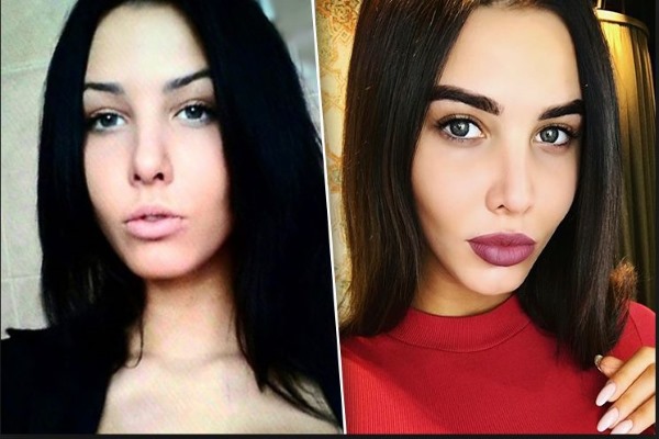 Anastasia Reshetova.Photos avant et après la chirurgie plastique, taille, poids de la fille, paramètres corporels