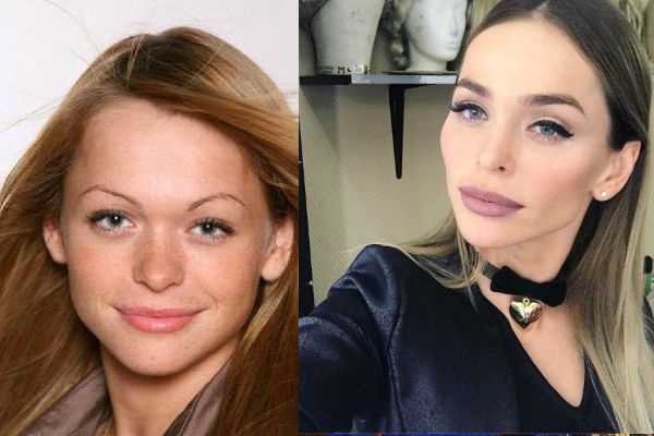 Anna Khilkevich antes y después de la cirugía plástica, altura, peso, parámetros corporales. Foto, biografía
