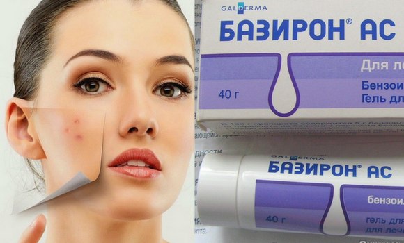 Baziron AS. Instruccions d'ús per a l'acne, preu, anàlegs, comentaris de dermatòlegs