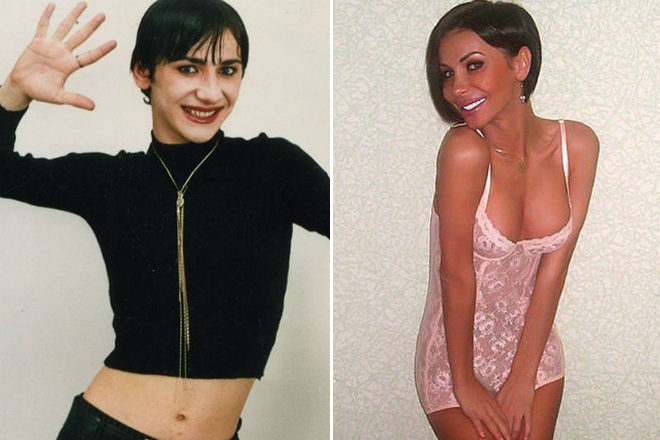 Erica Kisheva. Gambar sebelum dan selepas pembedahan penugasan semula seks, pembedahan plastik muka, badan, dada, tulang pipi, bibir