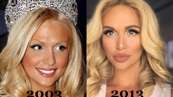 Gambar sebelum dan selepas plastik bintang Rusia, asing, Hollywood, rancangan perniagaan, panggung. Operasi yang berjaya dan tidak berjaya