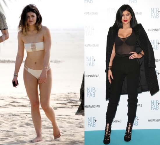 Kylie Jenner antes y después de la cirugía plástica: fotos sin maquillaje, photoshop, en traje de baño, embarazada. Cuántos años, altura, parámetros, biografía.