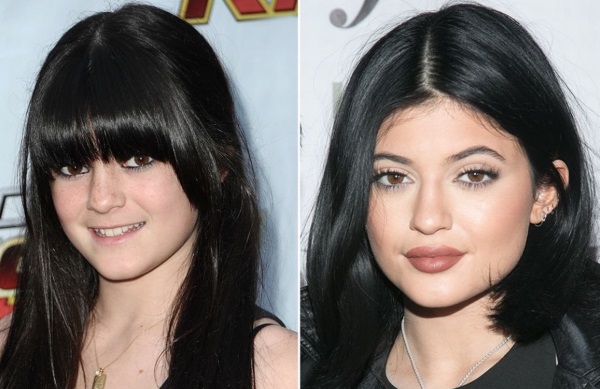 Kylie Jenner abans i després de la cirurgia plàstica: fotos sense maquillatge, photoshop, en banyador, embarassada. Quants anys, alçada, paràmetres, biografia