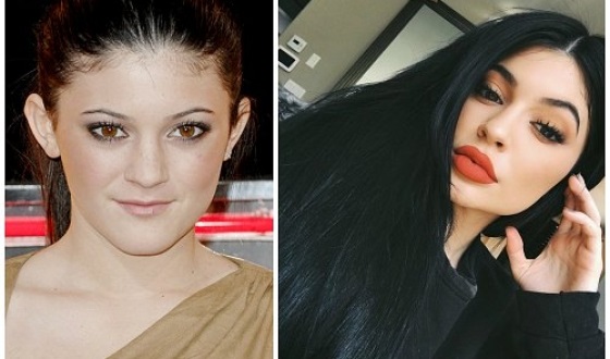 Kylie Jenner abans i després de la cirurgia plàstica: fotos sense maquillatge, photoshop, en banyador, embarassada. Quants anys, alçada, paràmetres, biografia