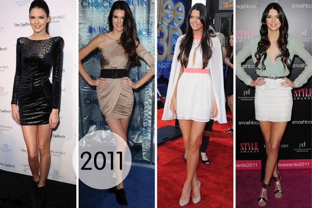 Kendall Jenner. Fotos abans i després de la cirurgia plàstica, en ple creixement. Operació als llavis, natges, parpelles, correcció del nas