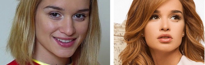 Ksenia Borodina. Fotos abans i després de la cirurgia plàstica i la pèrdua de pes. Quines operacions va fer l’estrella, biografia i vida personal