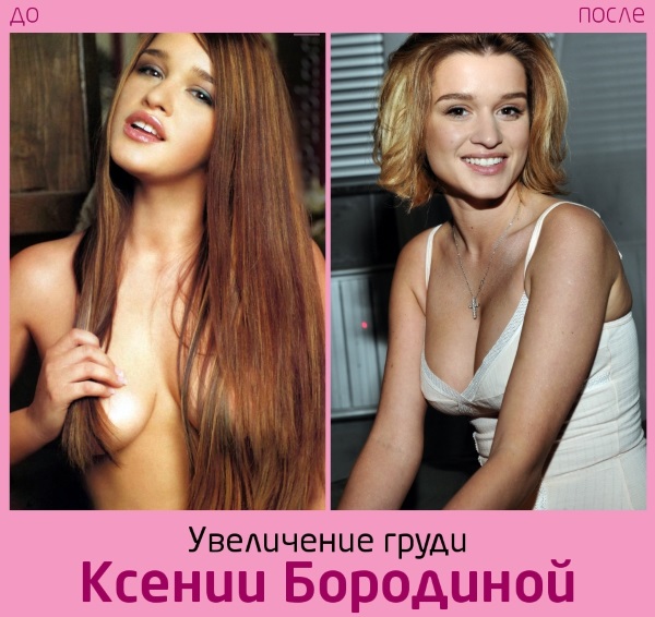 Ksenia Borodina. Foto's voor en na plastische chirurgie en gewichtsverlies. Welke operaties deed de ster, biografie en persoonlijk leven