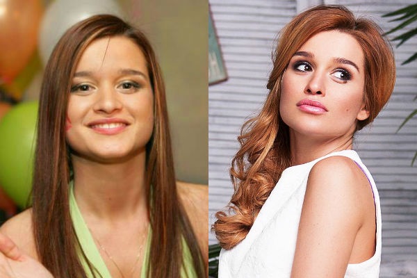 Ksenia Borodina. Photos avant et après la chirurgie plastique et la perte de poids. Quelles opérations a fait la star, biographie et vie personnelle