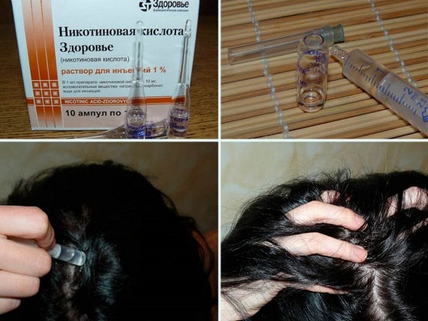 Ácido nicotínico para o crescimento do cabelo. Indicações, instruções de uso em ampolas, comprimidos, máscaras. Avaliações de tricologistas