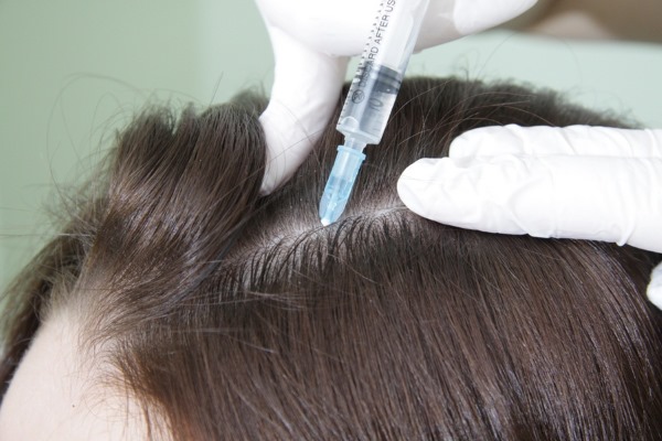 حمض النيكوتينيك لنمو الشعر. مؤشرات ، تعليمات للاستخدام في أمبولات ، أقراص ، أقنعة. تقييمات علماء الشعر