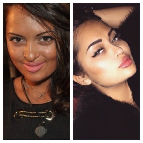 Nita Kuzmina sebelum dan selepas plastik. Foto, operasi yang dilakukan bintang itu, biografi