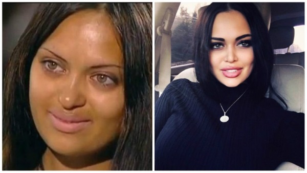Nita Kuzmina abans i després dels plàstics. Foto, quines operacions va fer l'estrella, biografia