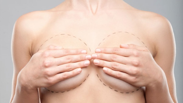 Mammoplasty-operation: reduktion, förstärkning, laser endoskopisk, utan implantat, maskuliniserande. Stadier, rehabilitering och komplikationer