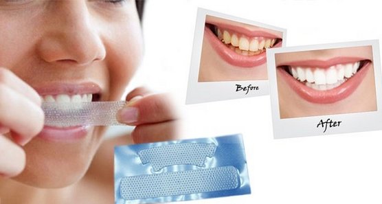 Tandblekningsremsor: 3d vit, Blend a Med, Crest, Rigel, Advanced tänder, Oral Pro, starkt ljus. Priser på apotek