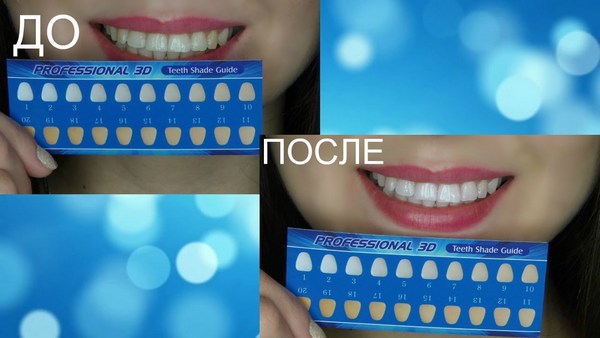 Strips voor het bleken van tanden: 3d wit, Blend a Med, Crest, Rigel, Geavanceerde tanden, Oral Pro, Helder licht. Prijzen in apotheken