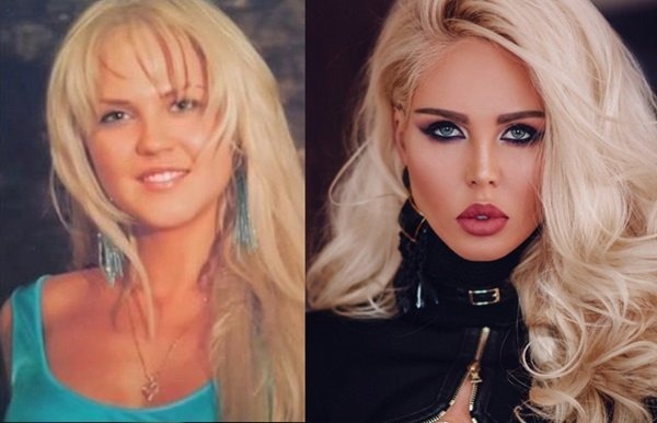 Maria Pogrebnyak antes y después de la cirugía plástica. Foto de Instagram, biografía y vida personal de la esposa del futbolista