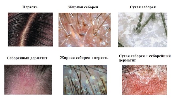 Pasta Sulcena. Instruções de uso para crescimento de cabelo, contra caspa, queda de cabelo, oleosidade