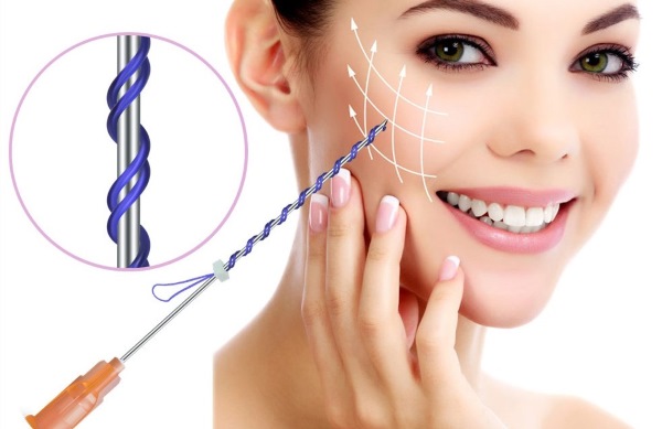 Fadenheben mit 3D-Mesothreads für Gesicht, Lippen, Stirn, Bauch. Vor und nach Fotos, Bewertungen, Preis des Verfahrens